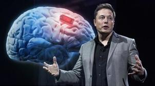Le cerveau connecté de Neuralink testé dès l'an prochain, selon Musk
