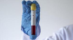 Coronavirus: 122 nouveaux décès en Iran, le bilan officiel monte à 1.934 morts