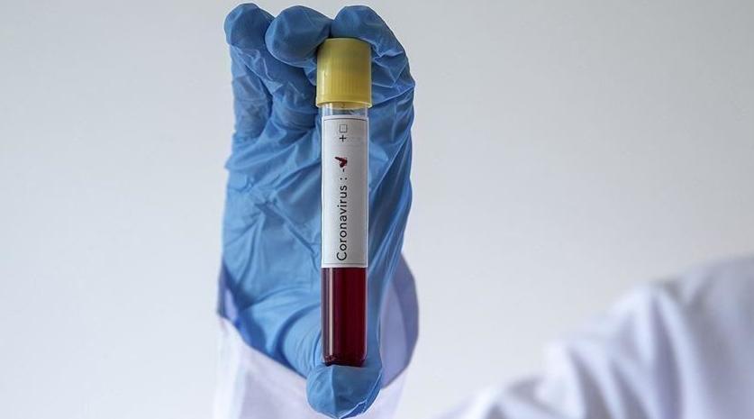 Mali/coronavirus: 3 nouveaux cas, 59 au total