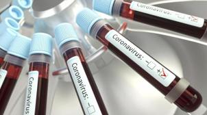 Covid-19: le rythme de progression des nouveaux cas en 24H ne cesse de ralentir…
