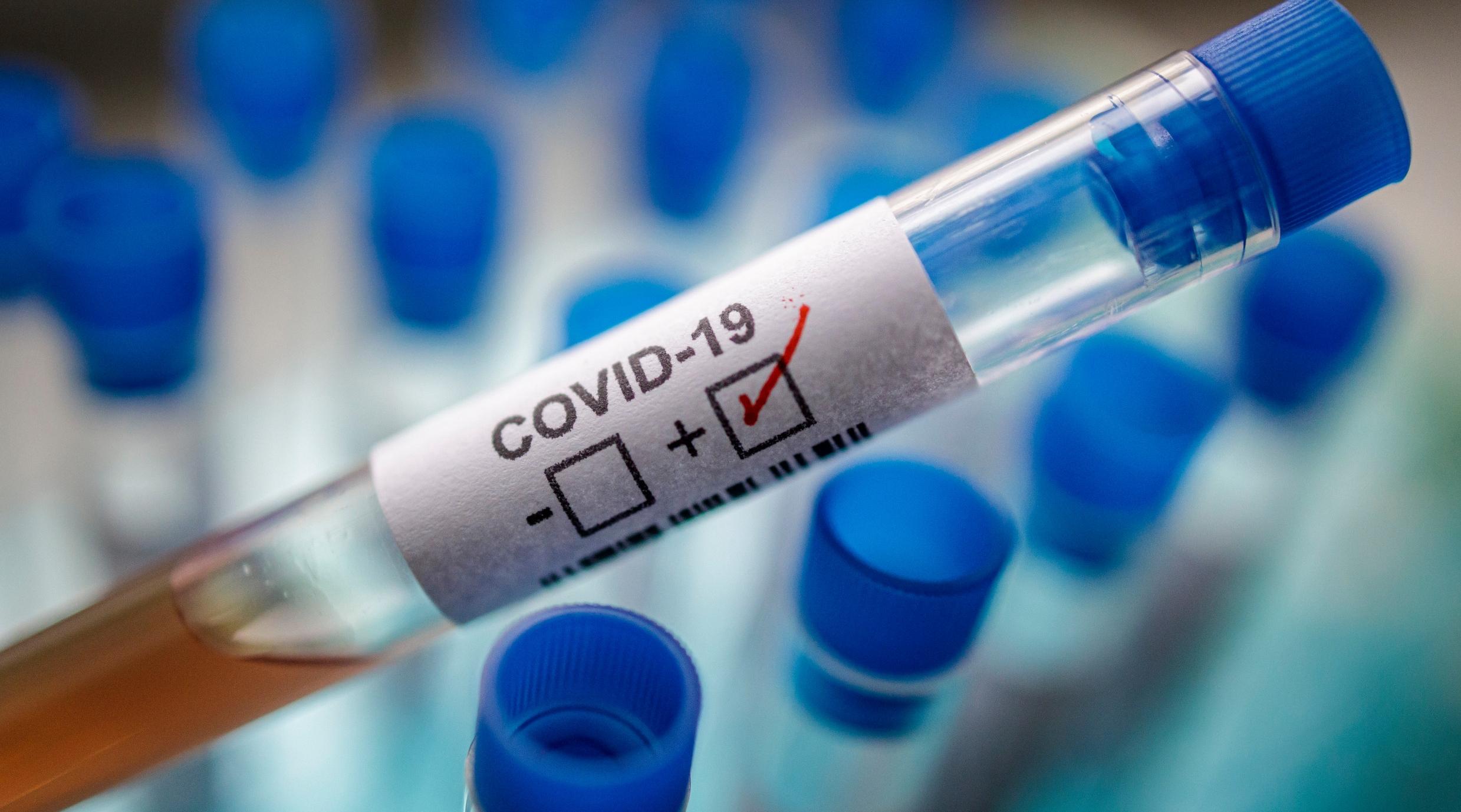 Etats-Unis: plus de 60.000 nouveaux cas de covid-19 pour le 5e jour d'affilée