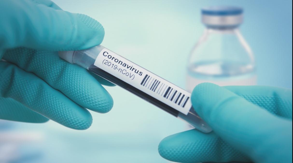 Rwanda/Coronavirus : 308 cas positifs, 209 guérisons (ministère de la Santé)