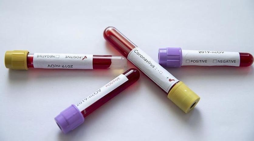 Côte d'Ivoire/Coronavirus : 261 cas, 37 guérisons et 3 décès