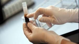 Le corticoïde anti-Covid-19 ne doit pas être donné au début de la maladie (nouv…