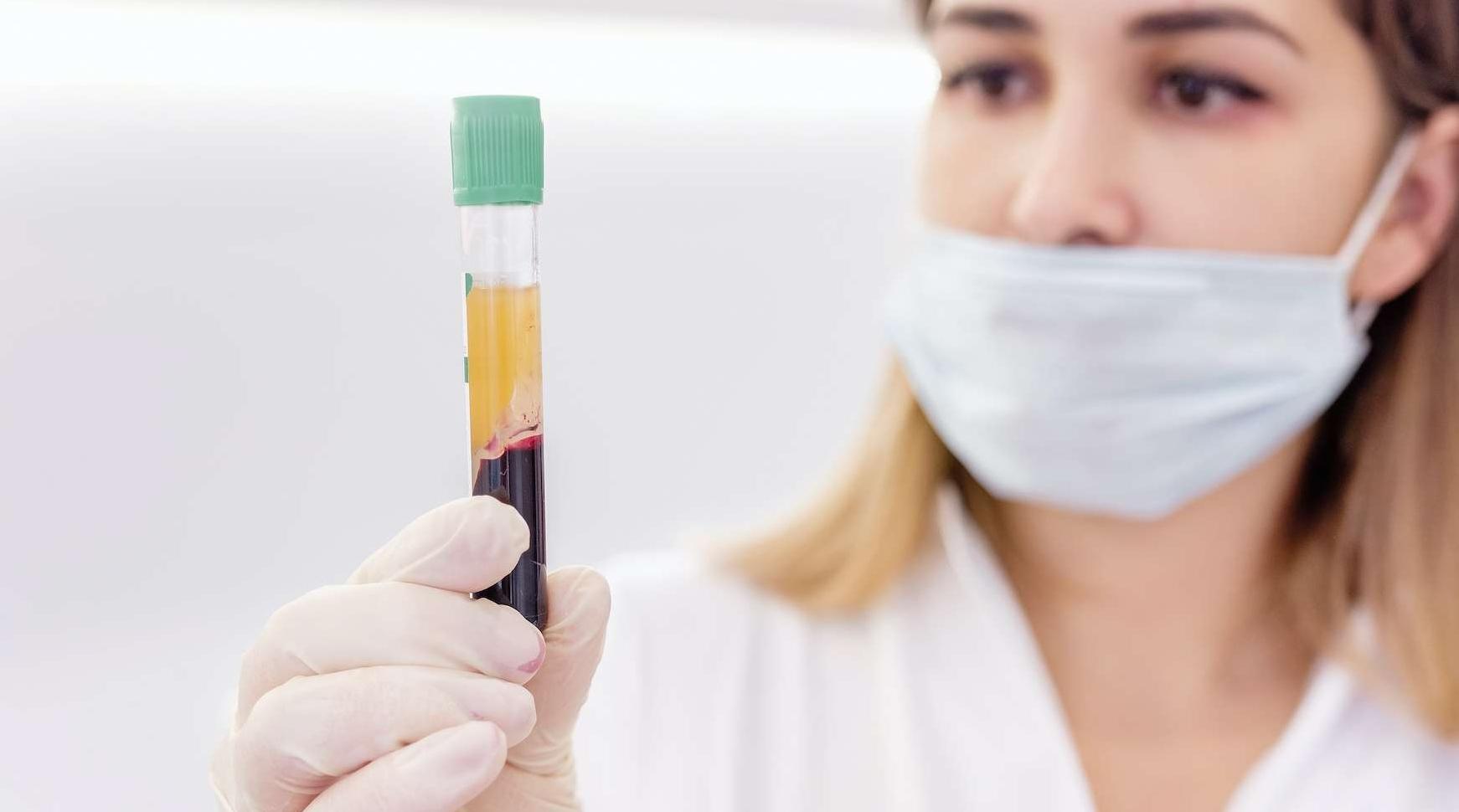 Vaccin anti-Covid-19 : Imperial College de Londres compte infecter des volontai…