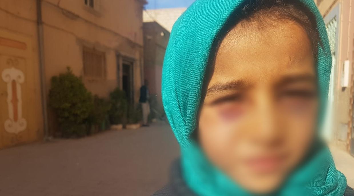 تأجيل جلسة البث في قضية تلميذة تارودانت المعنفة إلى يوم الأربعاء