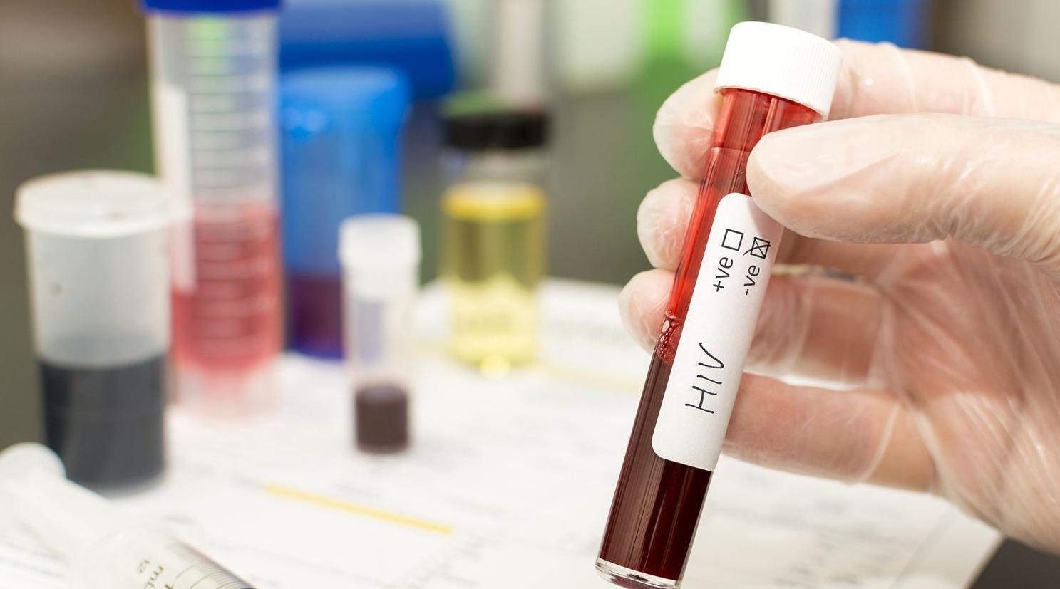 Echec de l'essai d'un vaccin contre le VIH en Afrique sub-saharienne