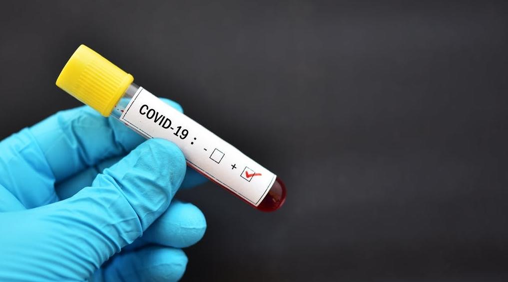 Coronavirus: décès d'une adolescente de 12 ans en Belgique