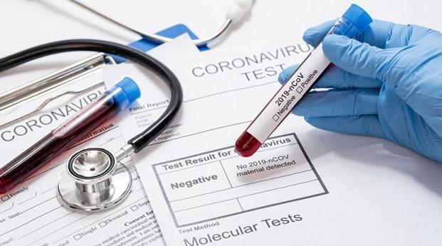 Maroc/Covid-19 : 36 décès et 1.583 nouvelles infections en 24H