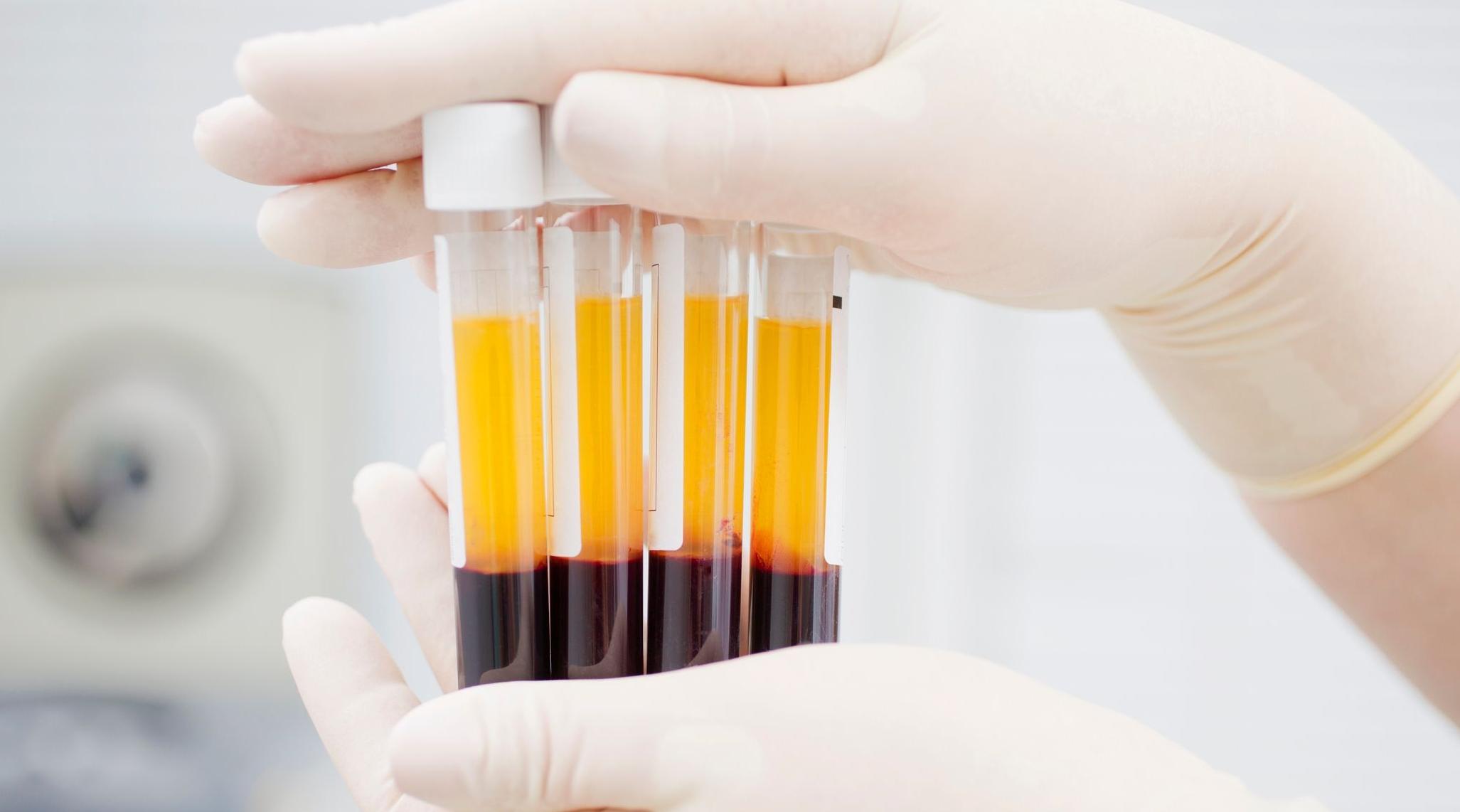 Covid-19: pas de preuve concluante sur les bénéfices du plasma sanguin (OMS)